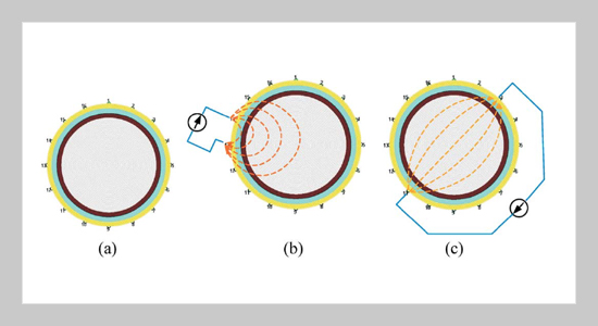 Misinterpretation of Scalp Voltage Response in the Application of Electrical Impedance Tomography to the Head