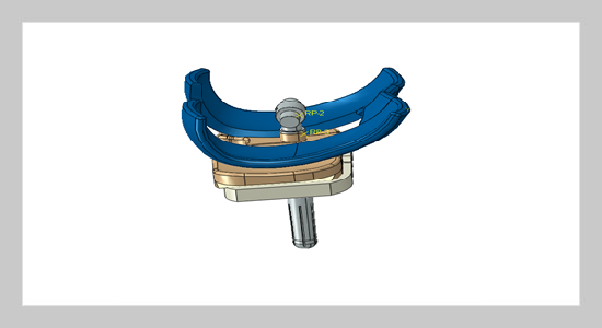 Motion simulation and finite element analysis of knee prosthesis with implant